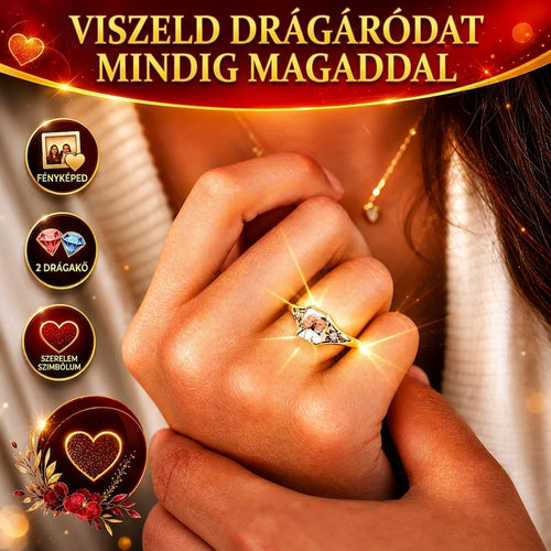 EternalLove™ – Személyre Szabható Fotós Gyűrű