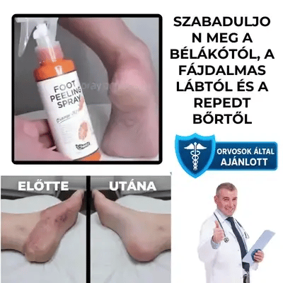 Professzionális Lábhámlasztó Spray – FrissLáb™