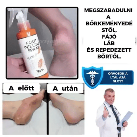 FootFresh™ hámlasztó spray